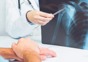 Female doctor's hand pointing to shoulder X-ray