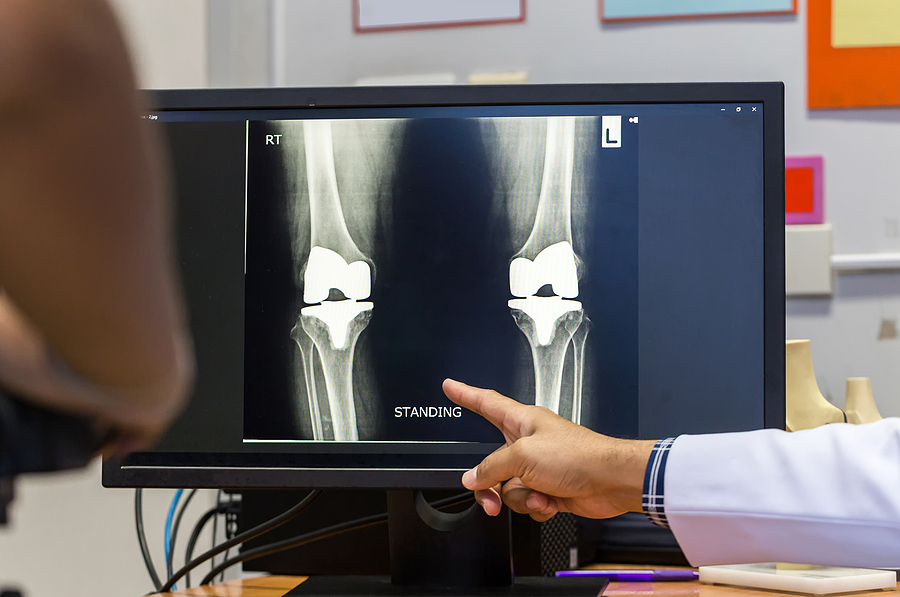 Same-Day Knee Surgery Arlington VA | Nirschl Orthopaedic Center